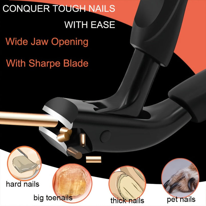 Ergonomische teennagelknipper; comfortabel en nauwkeurig voor professionele pedicure en ingegroeide nagels.