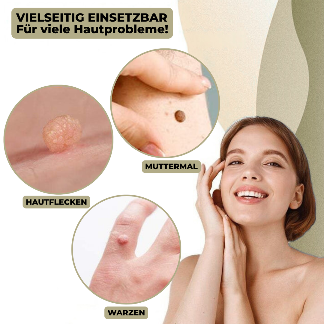 Gedetailleerde wrattenverwijderaar voor moedervlekken; precisie applicator voor veilige cosmetische behandeling.