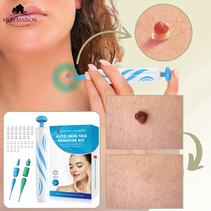 Pijnloze behandeling van wratten en moedervlekken met deze derma cosmetische thuisgebruik set.