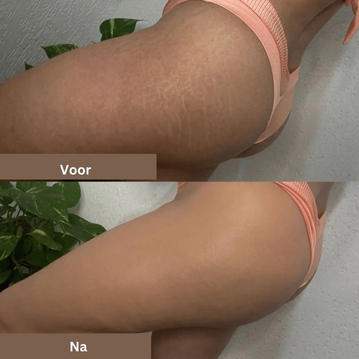 Langdurige waterbestendige concealer voor het vlekkeloos verbergen van littekens, vlekken en tatoeages.