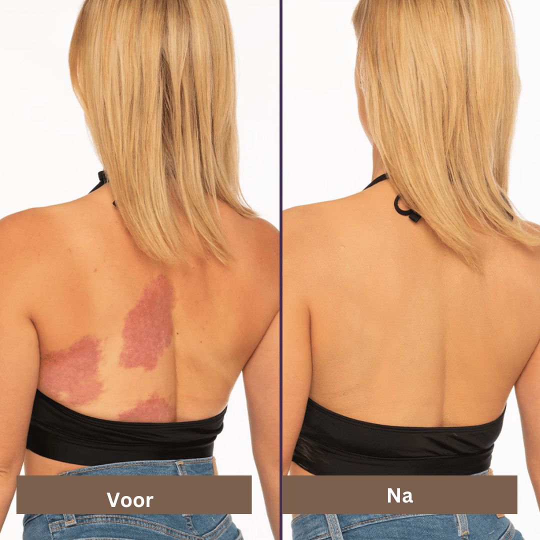Gezichtsmake-up: waterdichte concealer voor een egale teint, camoufleert vlekken en oneffenheden.